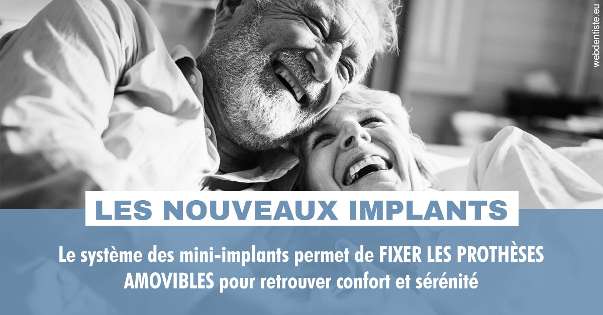 https://dr-tavel-vanessa.chirurgiens-dentistes.fr/Les nouveaux implants 2