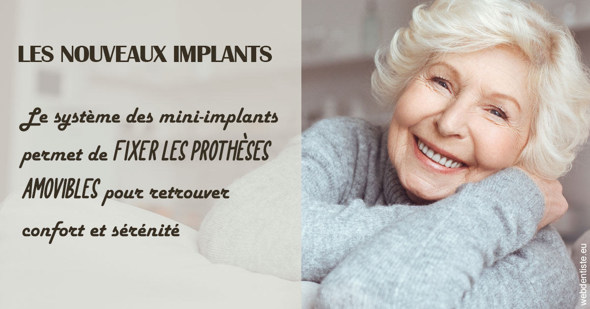 https://dr-tavel-vanessa.chirurgiens-dentistes.fr/Les nouveaux implants 1