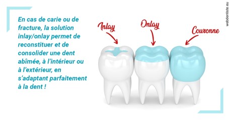 https://dr-tavel-vanessa.chirurgiens-dentistes.fr/L'INLAY ou l'ONLAY
