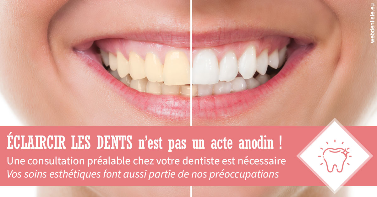 https://dr-tavel-vanessa.chirurgiens-dentistes.fr/Eclaircir les dents 1