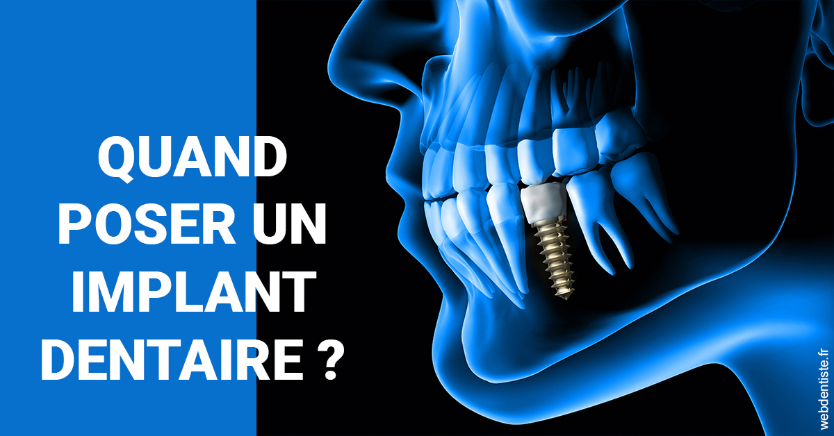 https://dr-tavel-vanessa.chirurgiens-dentistes.fr/Les implants 1
