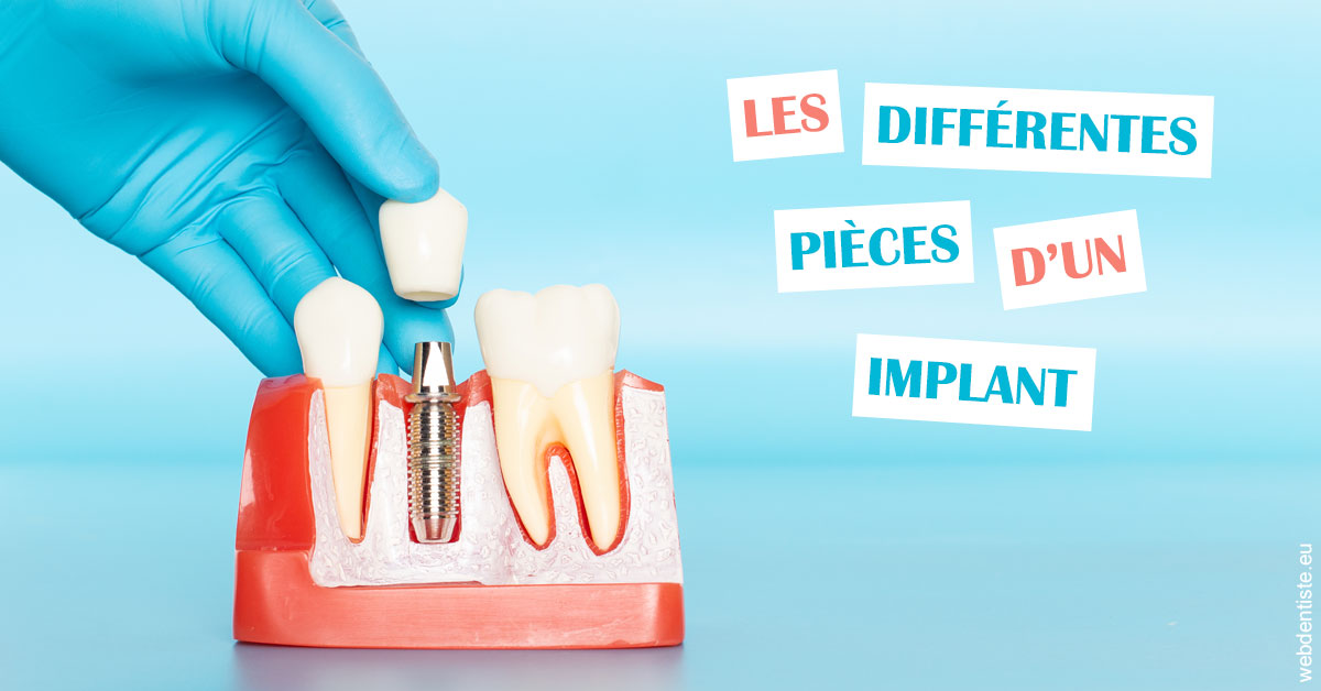 https://dr-tavel-vanessa.chirurgiens-dentistes.fr/Les différentes pièces d’un implant 2